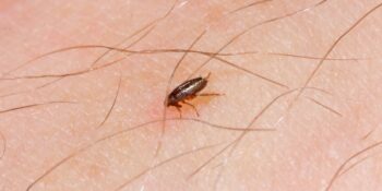 Flea on arm in Suffolk County & Nassau County | Suburban Exterminating