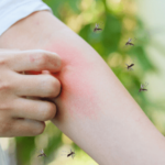 Person outside scratching red bug bite on arm while mosquitos swarm nearby