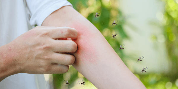 Person outside scratching red bug bite on arm while mosquitos swarm nearby