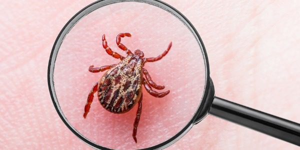 lyme disease