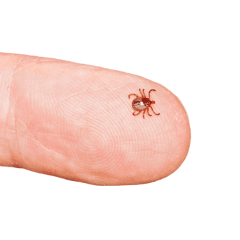 tick bite on finger