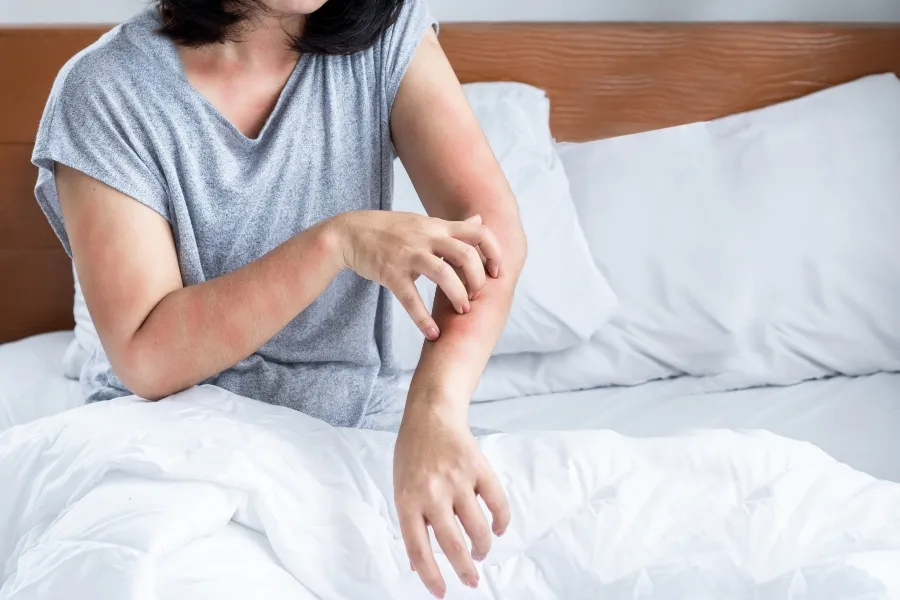 A woman sitting in bed scratching red, irritated bed bug bites on her forearm.